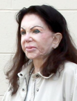 A exagerat cu operaţiile! Cum arată, la 92 de ani, mama lui Stallone